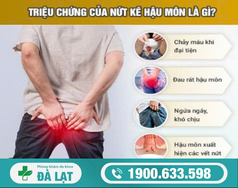 Hình ảnh minh họa